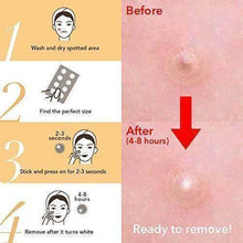 Load image into Gallery viewer, Skin Tag & Acne Patch