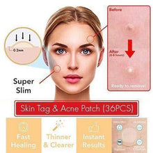 Load image into Gallery viewer, Skin Tag &amp; Acne Patch
